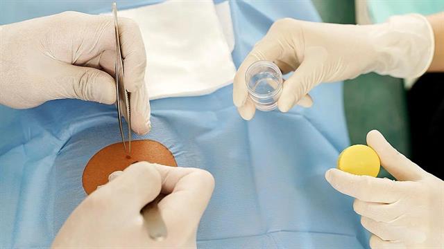 Η υγρή βιοψία διευκολύνει τον έλεγχο του μελανώματος