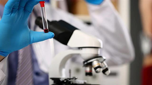 Η χρόνια λοίμωξη από ηπατίτιδα D συχνά δεν είναι ανιχνεύσιμη [μελέτη]