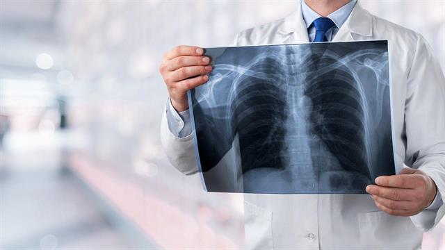 Η δεύτερη λοίμωξη από πνευμονιόκοκκο εμφανίζεται συχνά με γρίπη - Ο ρόλος του εμβολιασμού