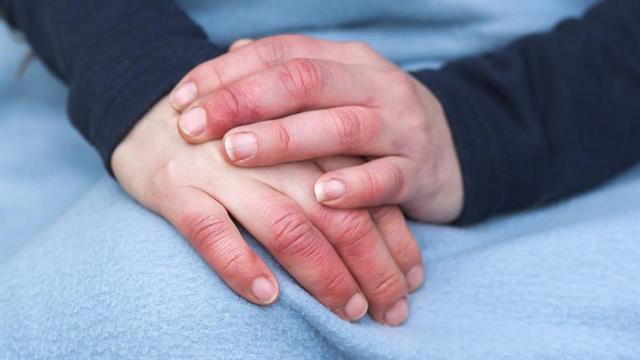 Κρύα χέρια ή πόδια: Αίτια και θεραπεία