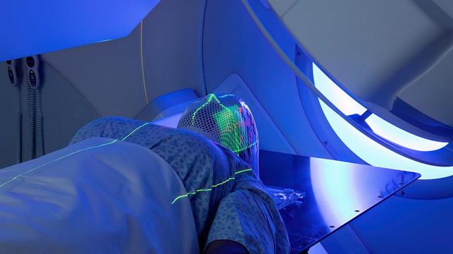 Νέα τεχνολογία για ακτινοβόληση των όγκων