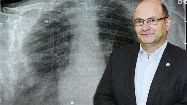 Ιστορία καρκίνου του πνεύμονα: Από τον Ιπποκράτη στις σύγχρονες θεραπείες