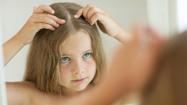 Παιδική τριχόπτωση: Πότε είναι ανησυχητική