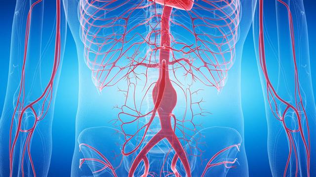 Ανεύρυσμα κοιλιακής αορτής: Συμπτώματα και αντιμετώπιση