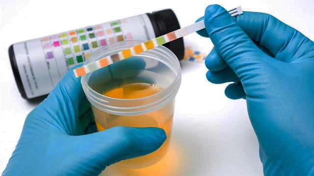 Κρύσταλλοι ούρων: Τι σημαίνουν τα αυξημένα επίπεδα