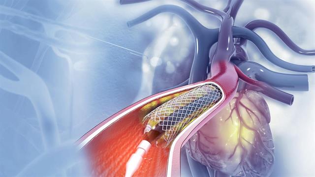 Αγγειακές Προθέσεις και Υλικά Αγγειοπλαστικής