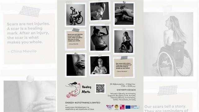 Healing Marks: Η δύναμη της αυτοαποδοχής και η κατάρριψη στιγματιστικών προτύπων ομορφιάς