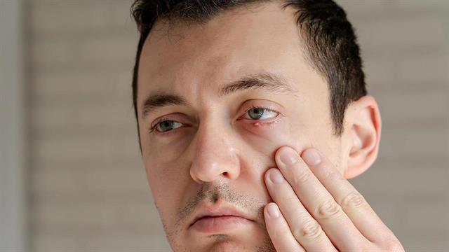 Πώς θεραπεύονται τo κριθαράκι και το χαλάζιο