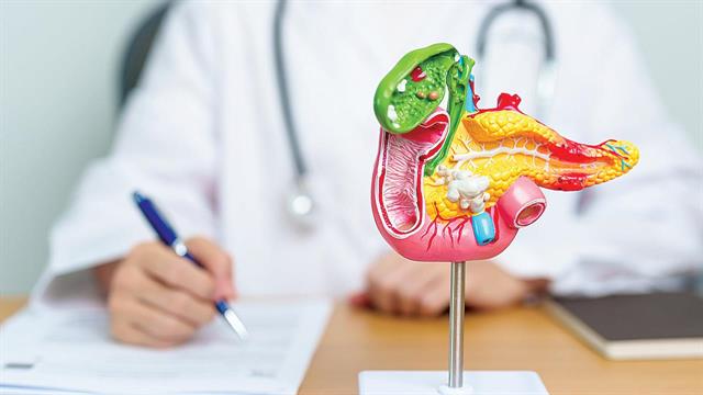 Συνδυασμός χρόνιου στρες και παχυσαρκίας επιταχύνει την ανάπτυξη καρκίνου στο πάγκρεας [μελέτη]