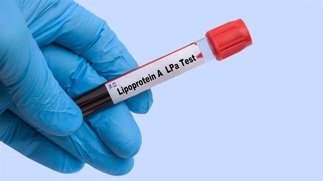 Σύγχρονες εξελίξεις για την Lp(a)