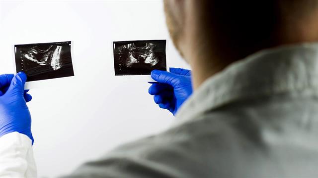 Καρκίνος του προστάτη: Συσκευή μικρο - υπερήχων αντικαθιστά την μαγνητική