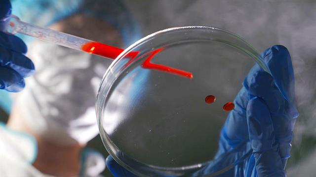 Ιός Epstein-Barr: Ποιοι είναι οι κίνδυνοι όταν ξυπνήσει