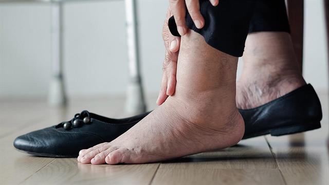 Εξωτερική εμφάνιση: Τι μπορεί να δείξει για προβλήματα υγείας