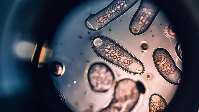 Νευρικά κύτταρα: Πώς ορίζουν την πείνα και τη δίψα