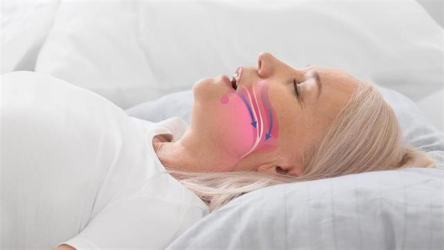 Η Samsung και η Ιατρική σχολή του Stanford συνεργάζονται για την ανίχνευση της υπνικής άπνοιας