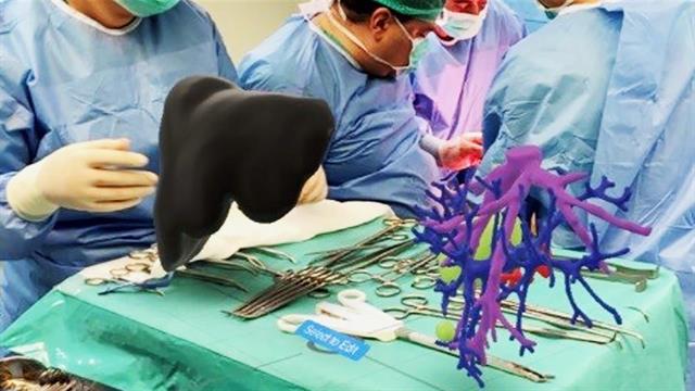 Εικονική πραγματικότητα, 3D όργανα και τεχνητή νοημοσύνη στη μεταμόσχευση