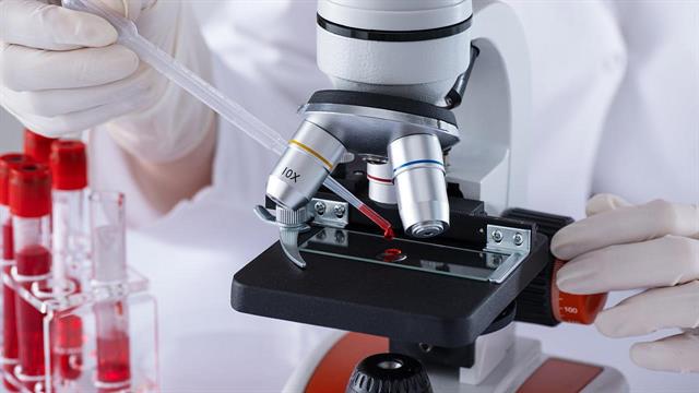 Μόλυνση από σκουλήκι αυξάνει τον κίνδυνο HIV [Μελέτη]