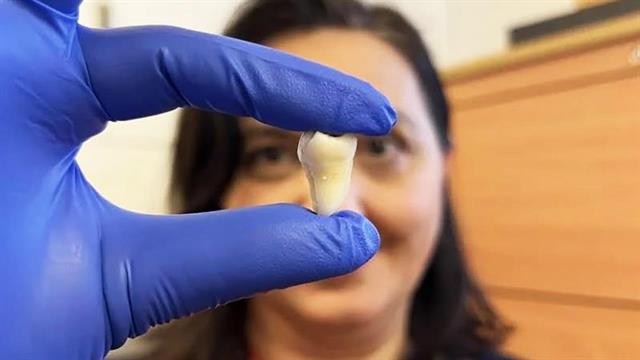 Εμφυτεύματα τέλος: Αναπτύχθηκε για πρώτη φορά ανθρώπινο δόντι στο εργαστήριο