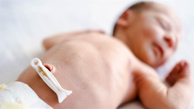 Ο ομφάλιος λώρος πιθανόν περιέχει στοιχεία για τη μελλοντική υγεία ενός παιδιού [μελέτη]