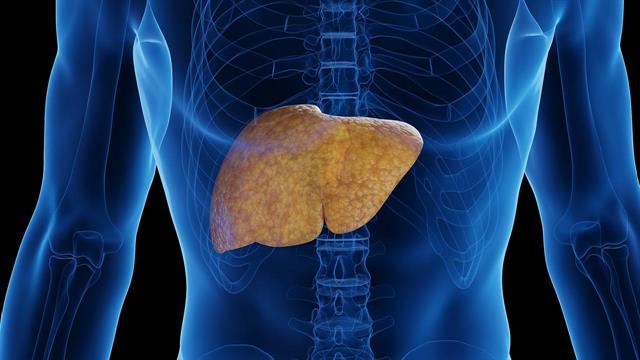 Εξέταση αίματος προβλέπει τη λιπώδη νόσο του ήπατος 16 χρόνια πριν την εμφάνιση συμπτωμάτων [μελέτη]