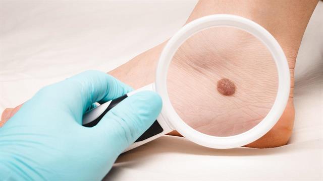 AI: Είναι αξιόπιστες οι εφαρμογές διάγνωσης δερματοπαθειών;