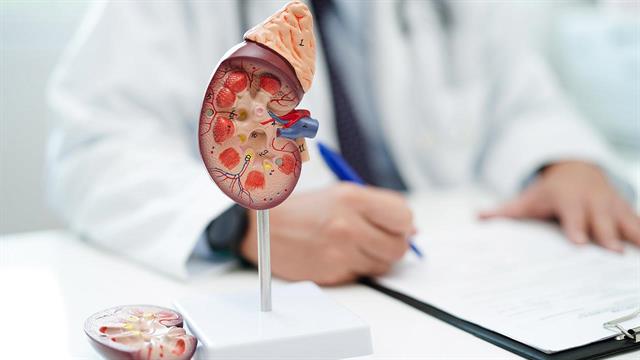 Πέτρες στα νεφρά: Τα πλεονεκτήματα της διαδερμικής λιθοτριψίας