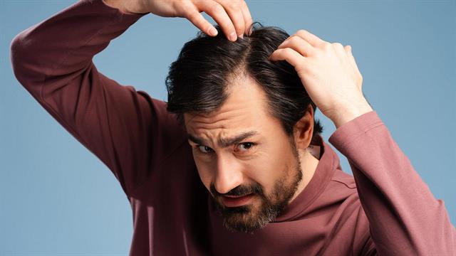 Παθήσεις τριχωτού κεφαλής: Πώς επηρεάζουν τη σωματική και ψυχική υγεία