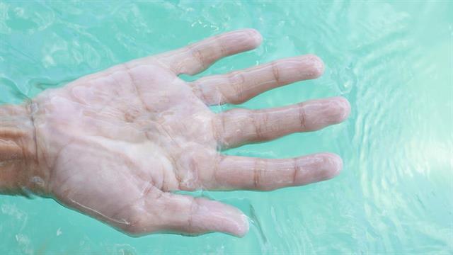 Γιατί ζαρώνουν τα δάχτυλα όταν κολυμπάμε;