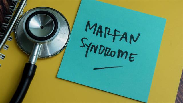 Aλλοπουρινόλη ως το  πρώτο ορφανό φάρμακο  για τη θεραπεία του συνδρόμου Marfan