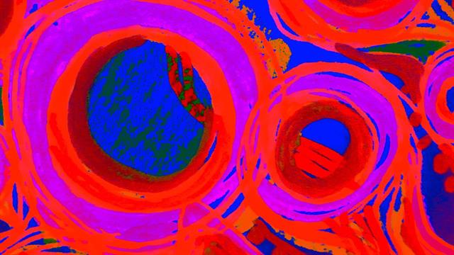 Όταν η τέχνη δημιουργεί καρκίνο και ο αλγόριθμος συναντά την ακουαρέλα