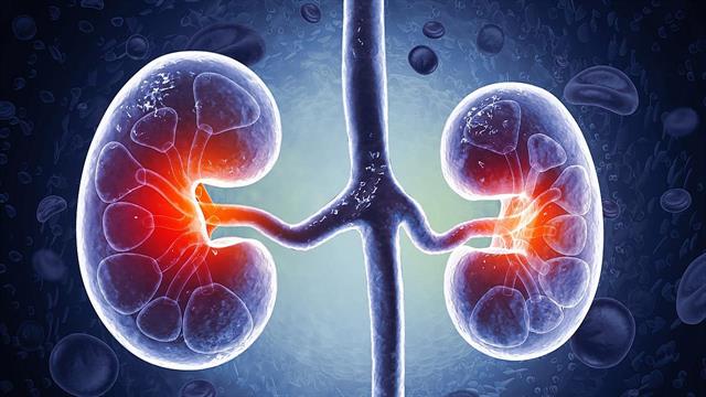 19η Ιουνίου, Παγκόσμια Ημέρα Καρκίνου του Νεφρού: Δείξτε λίγη αγάπη στα νεφρά σας