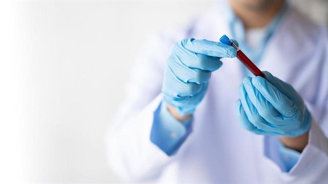 Εξέταση αίματος δείχνει τον καρκίνο χρόνια νωρίτερα πριν την κλινική διάγνωση
