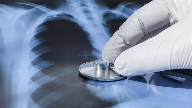 Πνευμονίτιδα: Η  βραχυπρόθεσμη  χορήγηση κορτικοστεροειδών δεν έχει αποτέλεσμα