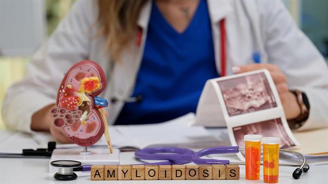 Κληρονομική αμυλοείδωση: Διαθέσιμη νέα θεραπευτική επιλογή