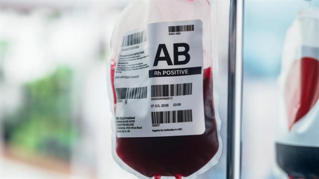 Χρήση του συστήματος αποθήκευσης υποξικών ερυθρών αιμοσφαιρίων Hemanext One® για μετάγγιση σε ασθενείς με θαλασσαιμία