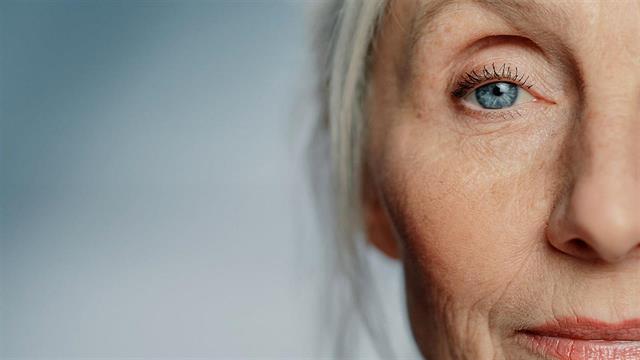 Καταρράκτης και καλοκαίρι: Πώς επηρεάζεται η όραση;