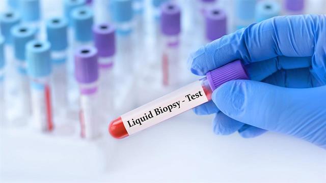 Η επανάσταση των υγρών βιοψιών στην αντιμετώπιση του καρκίνου