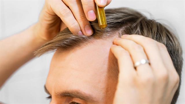 Τριχόπτωση & ευαίσθητο τριχωτό: Οι εξειδικευμένες λύσεις που αξίζει να γνωρίζετε