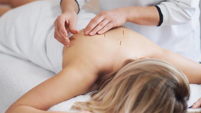 Ποια είναι τα οφέλη του βελονισμού