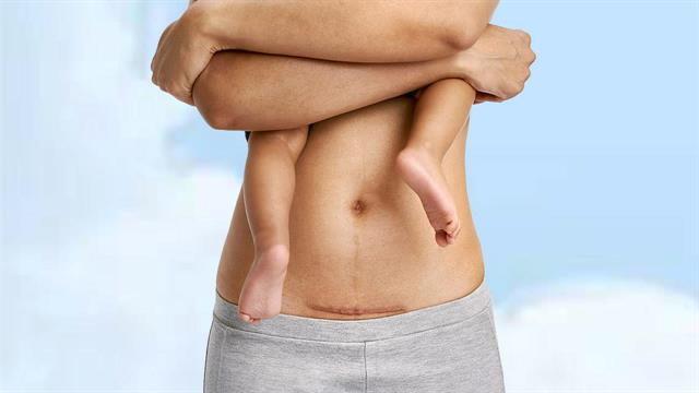 Το σώμα μου μετά τη γέννα: Αυτοφροντίδα χωρίς ενοχές