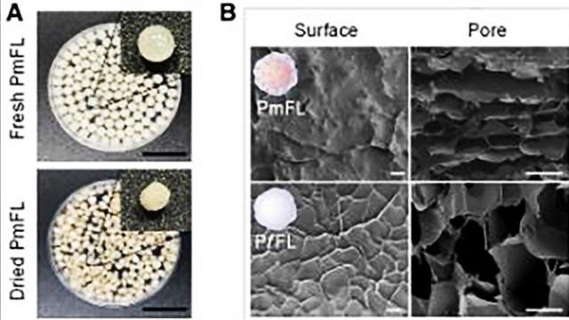 Μικροσφαιρίδια παγιδεύουν λίπος - Προκάλεσαν απώλεια βάρους χωρίς φάρμακα σε αρουραίους
