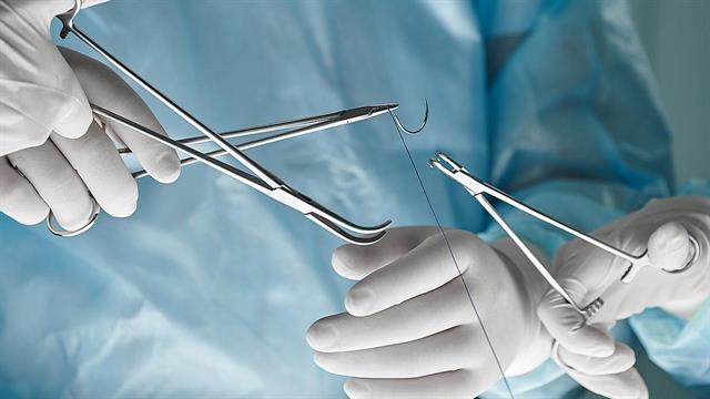 Μικροδισκεκτομή: Η λύση στον πόνο από δισκοκήλη