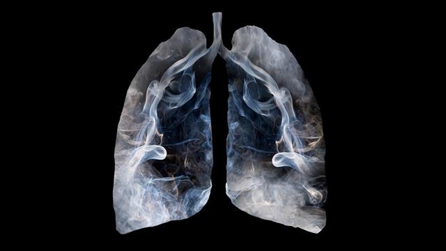 Γερμανικό κέντρο έρευνας για τον καρκίνο: Ένας στους επτά θανάτους οφείλεται στο κάπνισμα