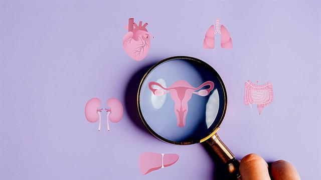 Σύνδρομο πολυκυστικών ωοθηκών και διατροφή: Σχετίζονται;