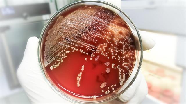 Η υπερ-κόλλα της φύσης: Οι σταφυλόκοκκοι προσκολλώνται στο δέρμα με δύναμη - ρεκόρ