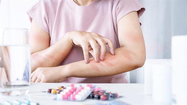 Nέα μέθοδος συμβάλλει στον ποιοτικό έλεγχο των φαρμάκων για τη θεραπεία των αλλεργιών