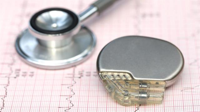 Ερευνητές δημιούργησαν αντίγραφο του ηλεκτρικού συστήματος της καρδιάς