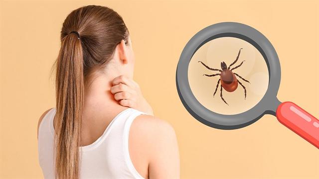 Τσιμπήματα εντόμων: Είναι δυνητικά θανατηφόρα;