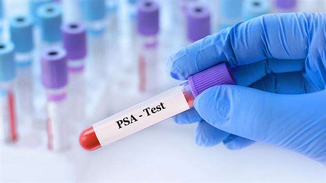 Καρκίνος προστάτη: Σύγχρονες διαγνωστικές και θεραπευτικές λύσεις