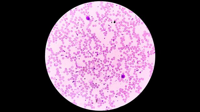 Η Agios έλαβε τη θετική γνωμοδότηση για το Pyrukynd